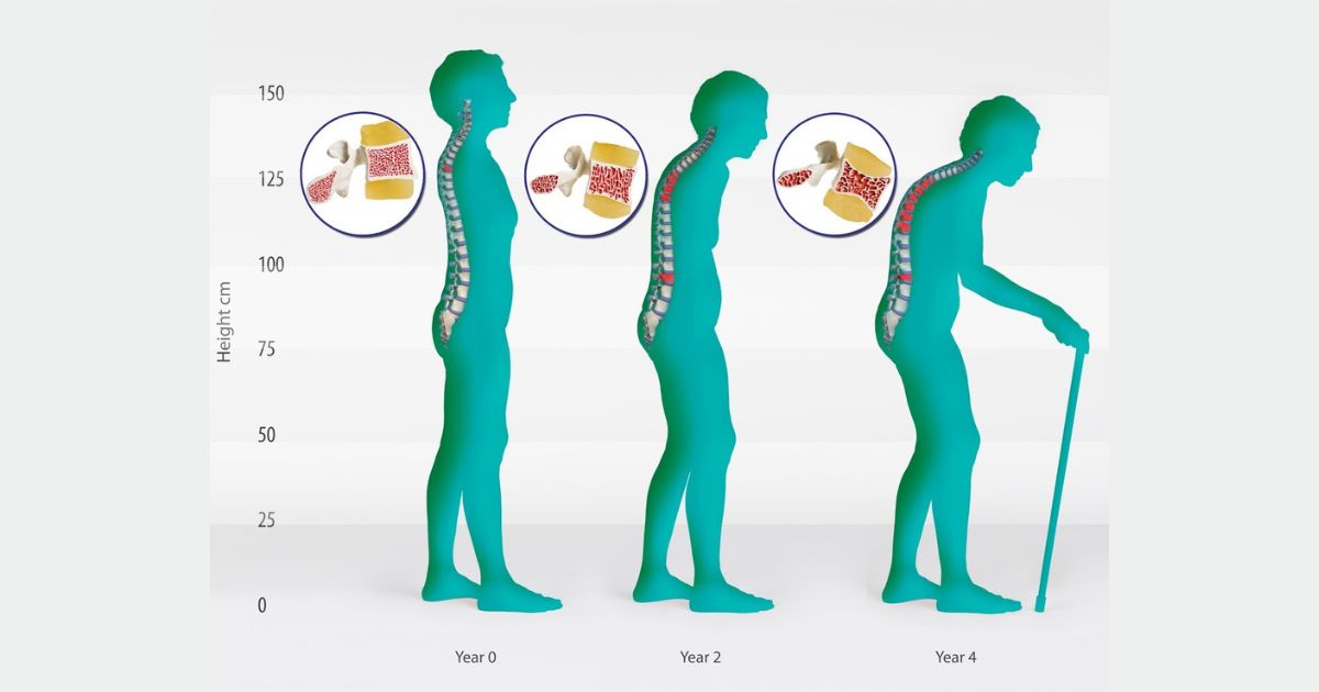 osteopur